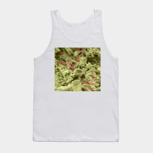 Pseudomonas lung infection, SEM (C021/7004) Tank Top